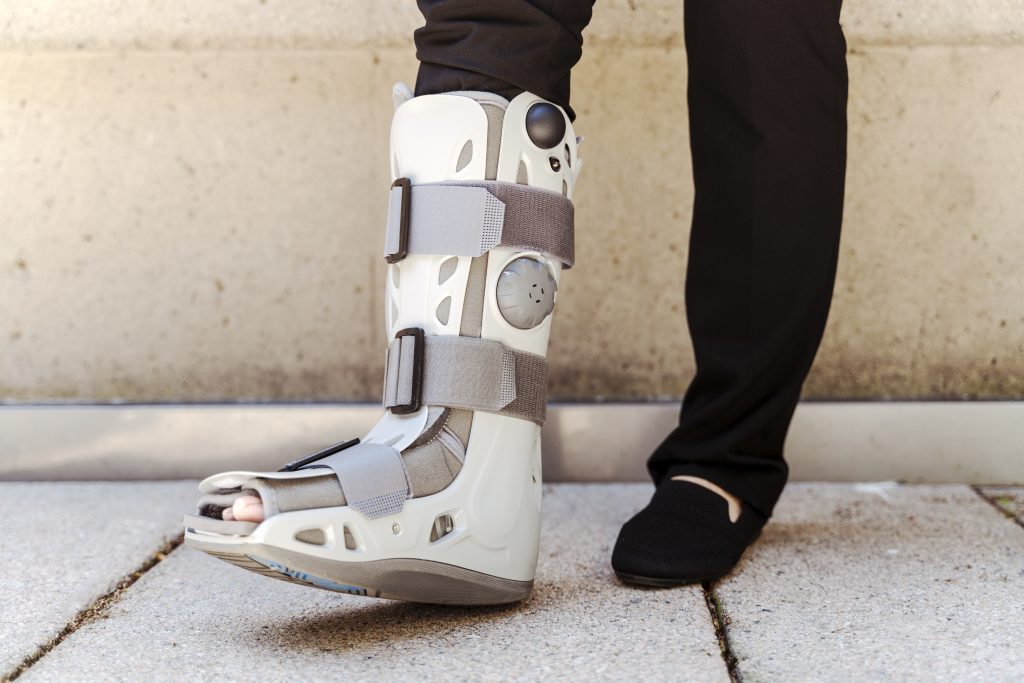 Patient wearing a walking boot during their bunion surgery recovery
