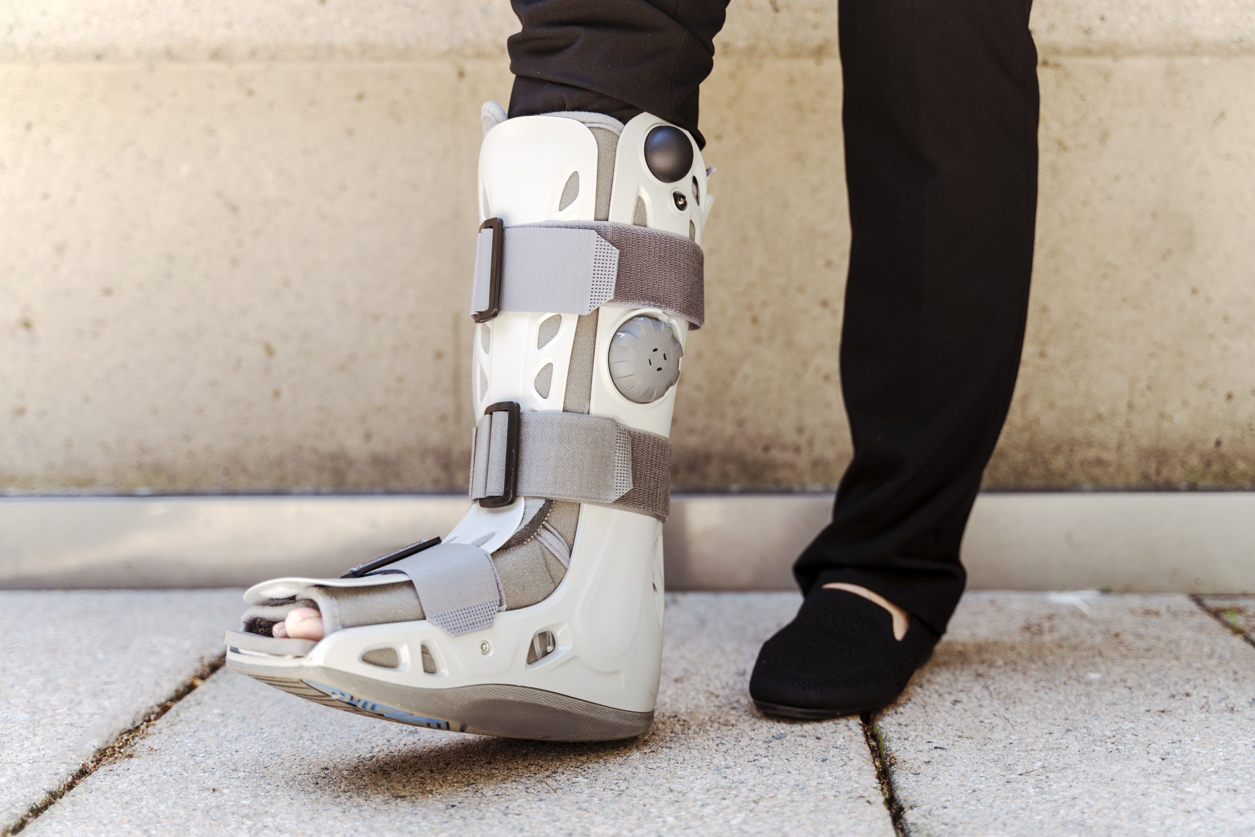 Patient wearing a walking boot during their bunion surgery recovery