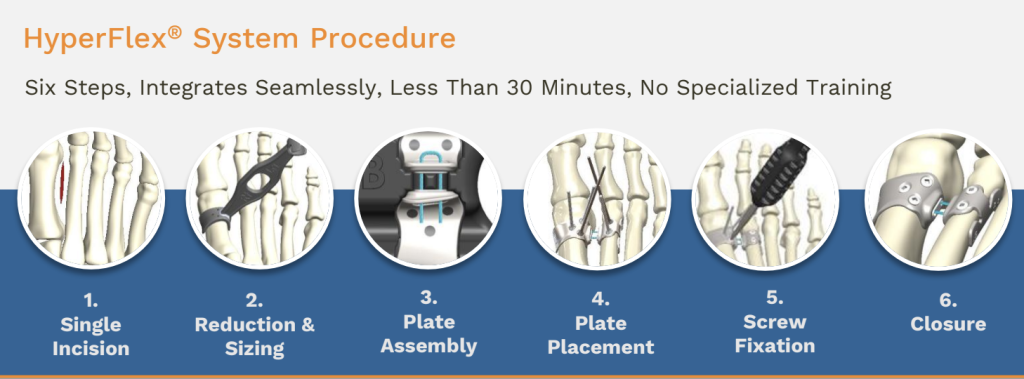 An overview of the HyperFlex system